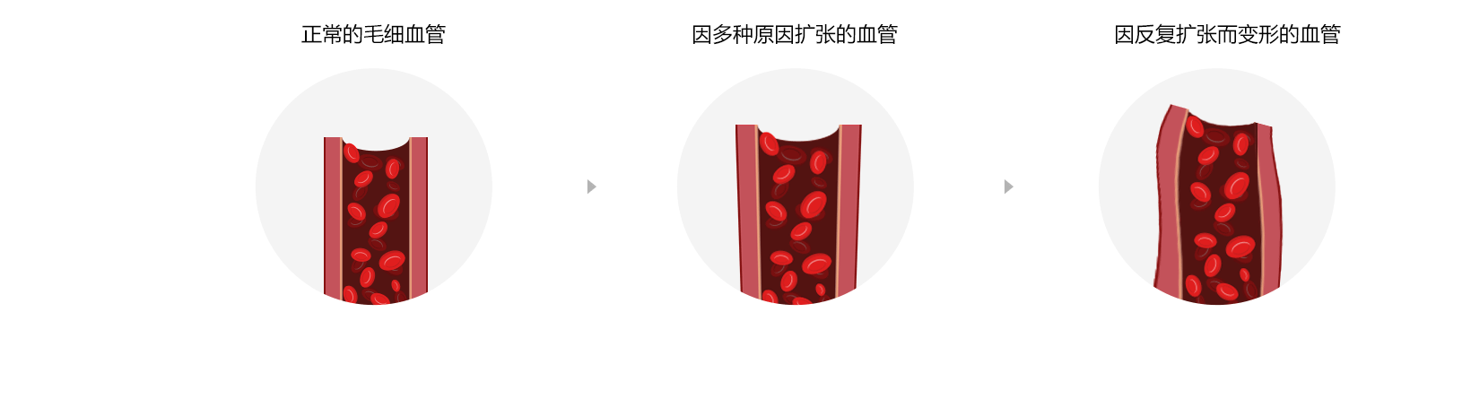 沿ëϸѪʾͼ
